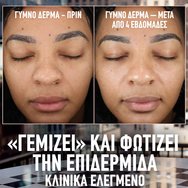 Maybelline Lifter Plump & Glow SPF15 Foundation 30ml - 336