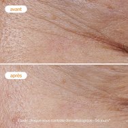 Novexpert Vitamin C Light Cream Дневен крем за лице с лека текстура и витамин C, подходящ за всеки тип кожа 40ml