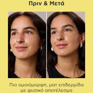 Isdin Acniben 2 Spf30 CC+ Cream Хидратиращ крем за лице с висока слънцезащита и цвят за мазна и склонна към акне кожа против несъвършенства 40ml - Medium Isdin Acniben 2 Spf30 CC+ Cream Хидратиращ крем за лице с висока слънцезащита и цвят за мазна и склонна към акне кожа против несъвършенства 40ml - Medium