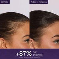 Caudalie Anti-Hair Loss Serum Серум за слаба, тънка коса, против реактивен косопад, свързан със стрес, сезонни промени, раждане 50ml Caudalie Anti-Hair Loss Serum Серум за слаба, тънка коса, против реактивен косопад, свързан със стрес, сезонни промени, раждане 50ml